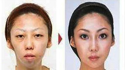 Китаец засудил экс-жену за ложь о пластике