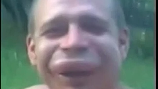 Жительница Владикавказа решила «сдуть» накачанные губы, но всё пошло не по плану
