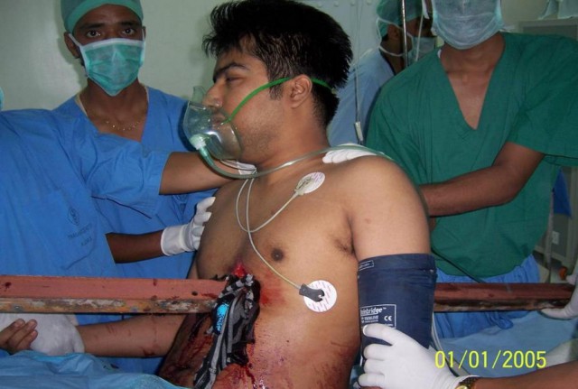 Португальский парень чудом выжил, после того как его проткнуло железякой