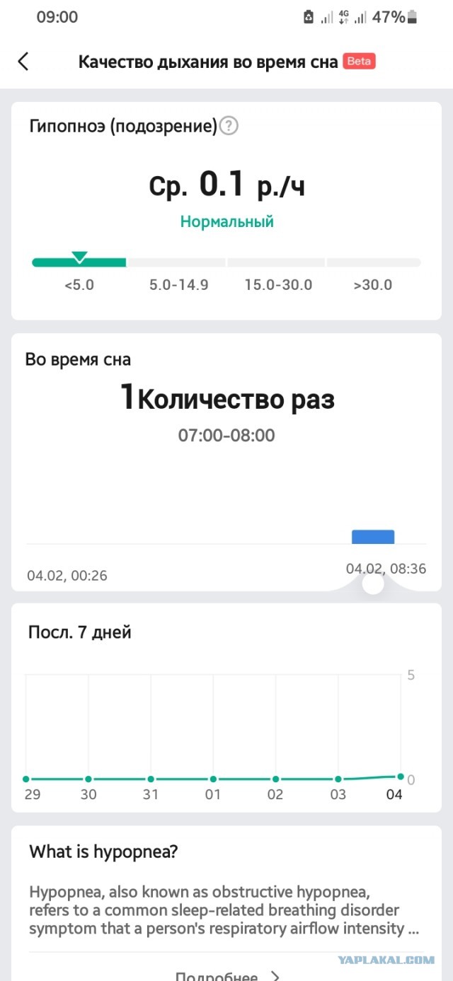 Сонное апное! Или как после многих лет нашёл свою проблему
