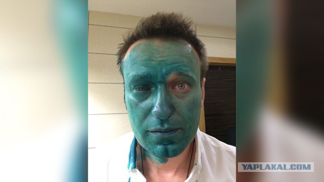 Алексея Навального облили зелёнкой в Москве