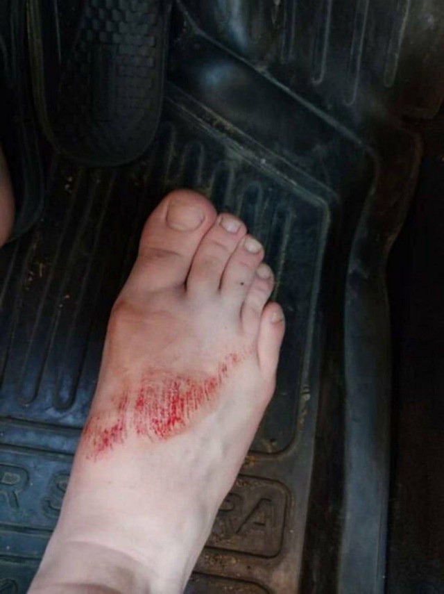 В Башкирии сом схватил купающегося ребенка за ногу и попытался утащить за собой