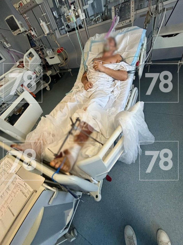 «Какого хрена с голым торсом»: петербуржец оголился в Абхазии и получил ранение в ногу