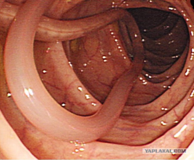 Воздействие бутирата