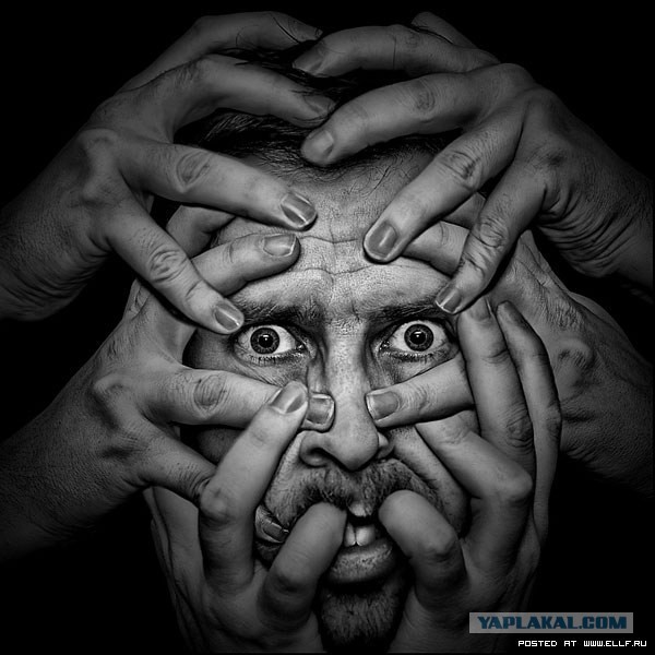 Интересные синдромы