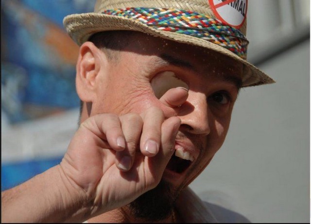 Потерял пол-лица и стал профессиональным зомби