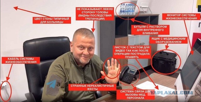 Залужный получил ранения при ракетном ударе