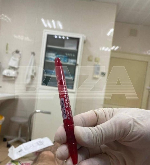 В Москве подросток засунул себе в уретру ручку «ради эксперимента».