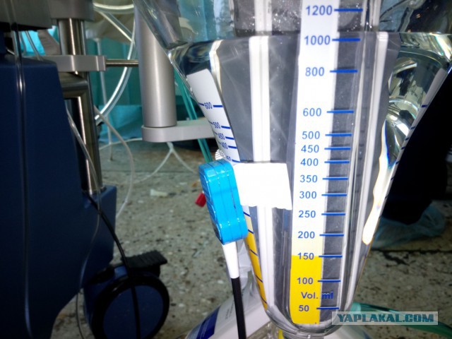 Искусственное кровообращение