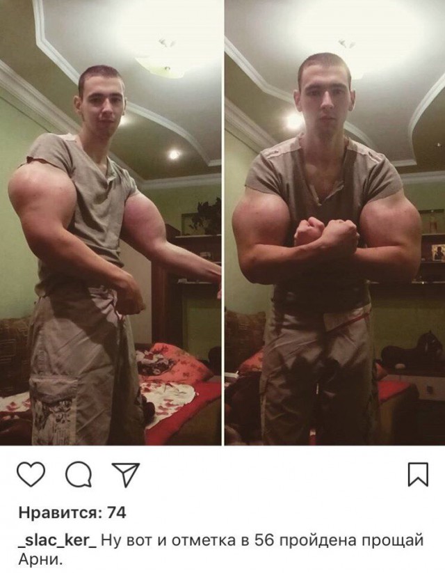 "Химическому качку" из Пятигорска грозит ампутация рук
