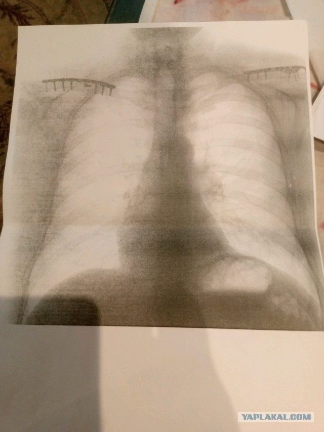 Питер. Очень скользко