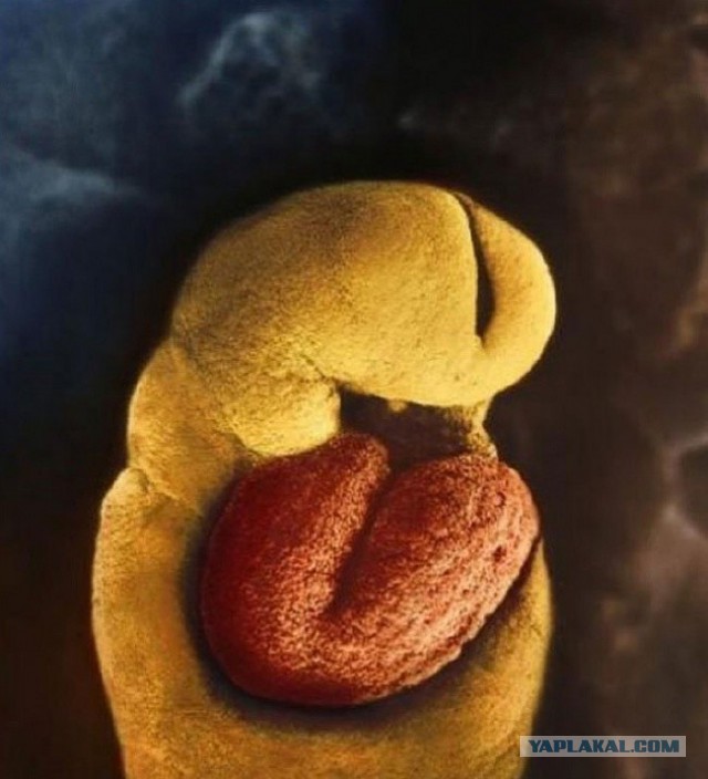 Начало жизни: от зачатия до рождения (24 фото)