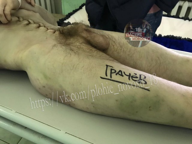 Во Владимирском централе признались в пытках заключенных музыкой с LoveRadio