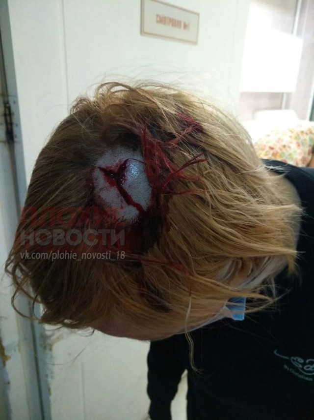 Омичке в голову попала выброшенная из окна бутылка из-под алкоголя