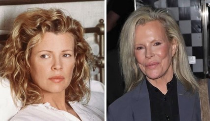 Поклонники перестали узнавать 69-летнюю известную актрису Ким Бейсингер