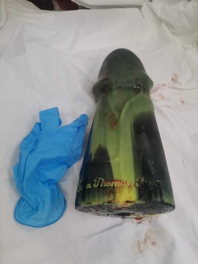 Очередной любитель больших предметов доигрался до инвалидности....