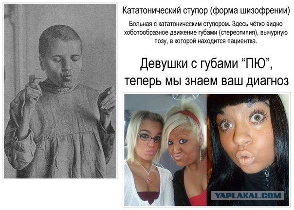 Девушки с губами пью теперь мы знаем ваш диагноз !