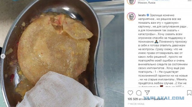 Стоячие соски