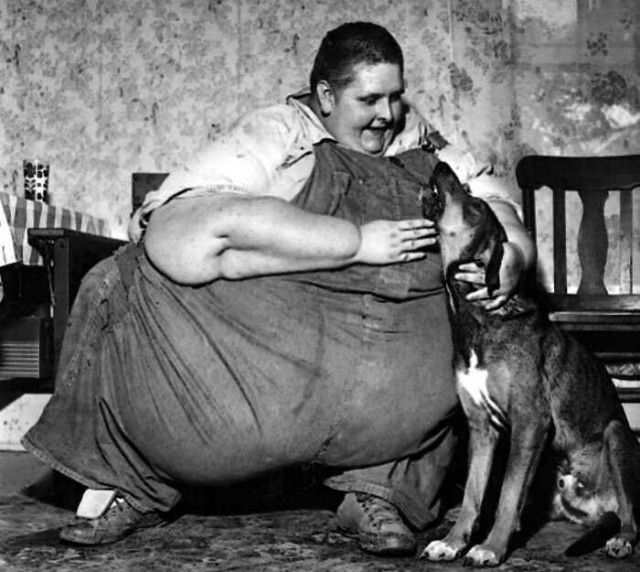 Роберт Эрл Хьюз был одним из самых тяжёлых людей в истории медицины, который ходил без посторонней помощи