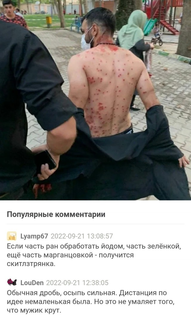 Во время протеста против ношения хиджаба в Тегеране мужчина заслонил собой нескольких женщин и взял на себя всю дробь из дробовика