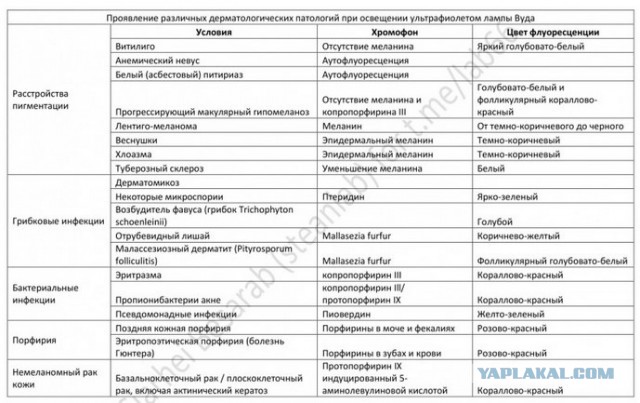 Толщиномер в прошлом