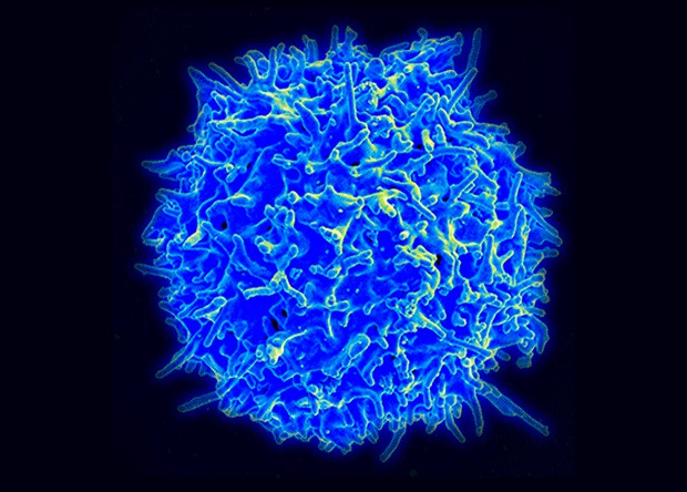 Иммунотерапия помогла ранее безнадежным онкобольным