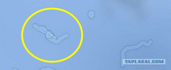 Как меня в психи записывали