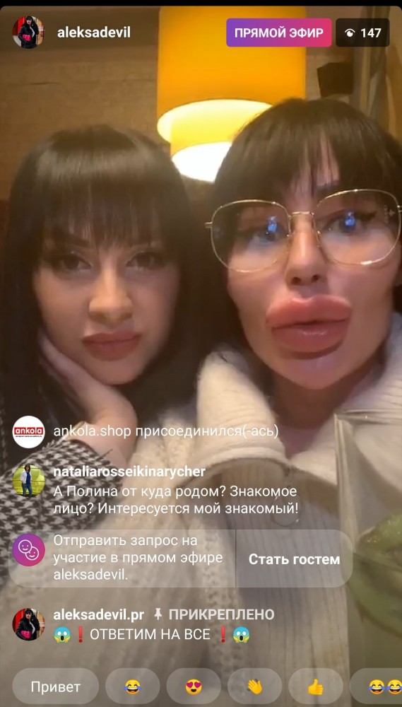 "Блохерша" с Урала испугала своими губами жениха