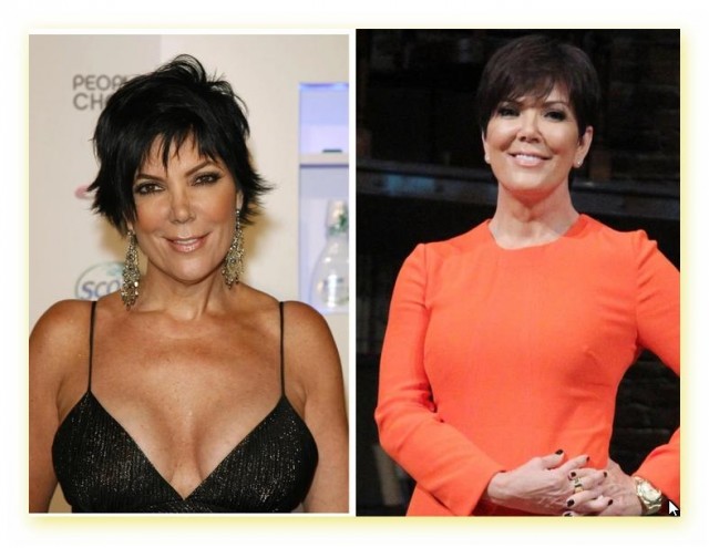 Знаменитости, которые уменьшили себе грудь