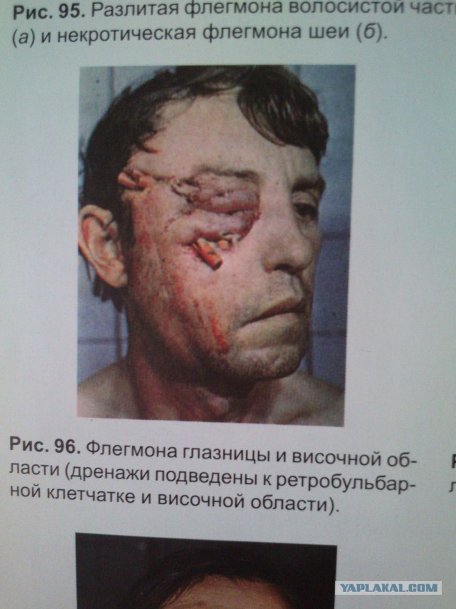 «Я пережил пытки в реанимации и остался инвалидом»