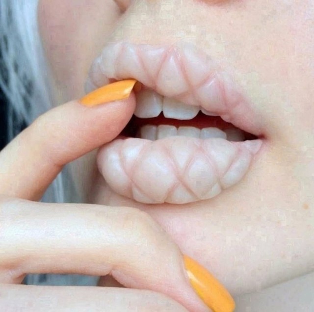 Мода на губы "уточкой" уходит в прошлое