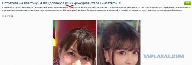 Потратила на пластику 64 000 долларов и из крокодила стала симпатягой