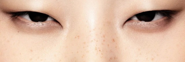 Эффект «заячьих губок»: результатами новой авторской методики поделилась косметолог-уродолог в сети