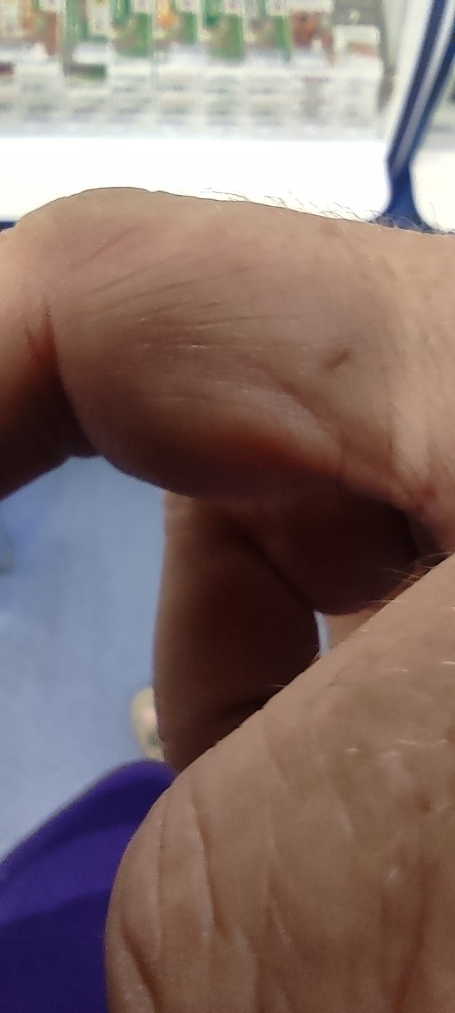 Чей укус??