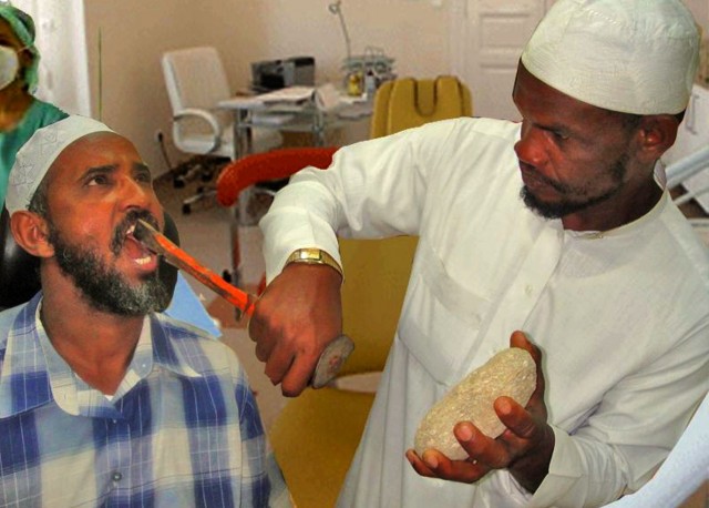 В России рост цен на стоматологию достиг 250%