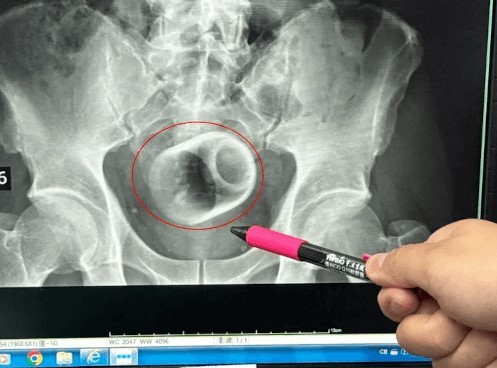 Опять кто-то неудачно поскользнулся..