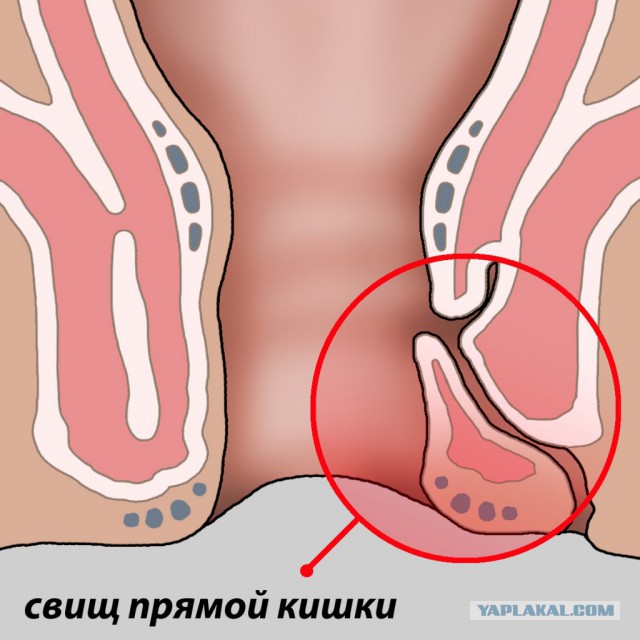 Пальцем в ж…
