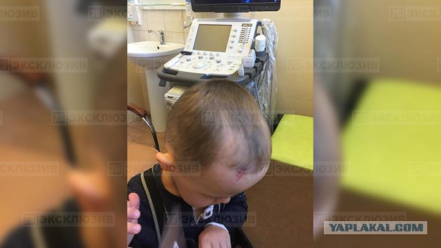 ОнЖеОтец и ОнаЖеМать подняли все службы из-за царапины ребенка в детском саду. Приехала полиция, скорая и даже прокуратура!