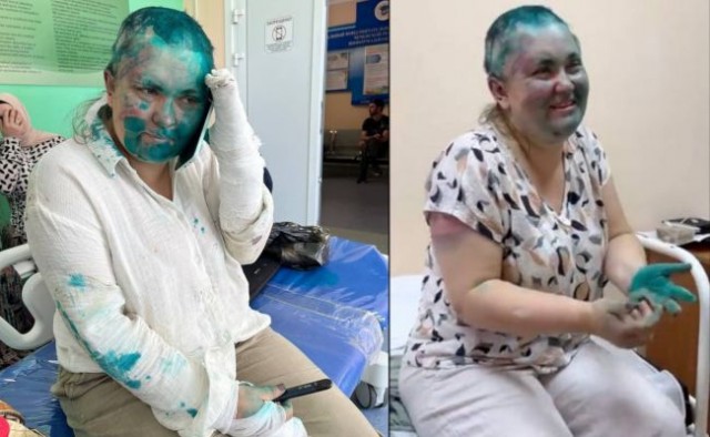 Переломы рассосались — Милашина и Немов уже в московской больнице