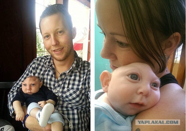 Мальчик без мозга продолжает жить! Ему уже год и ПЯТЬ месяцев!