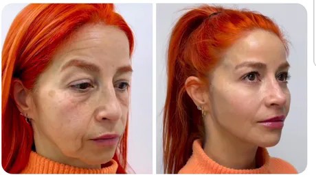 Современная пластическая хирургия