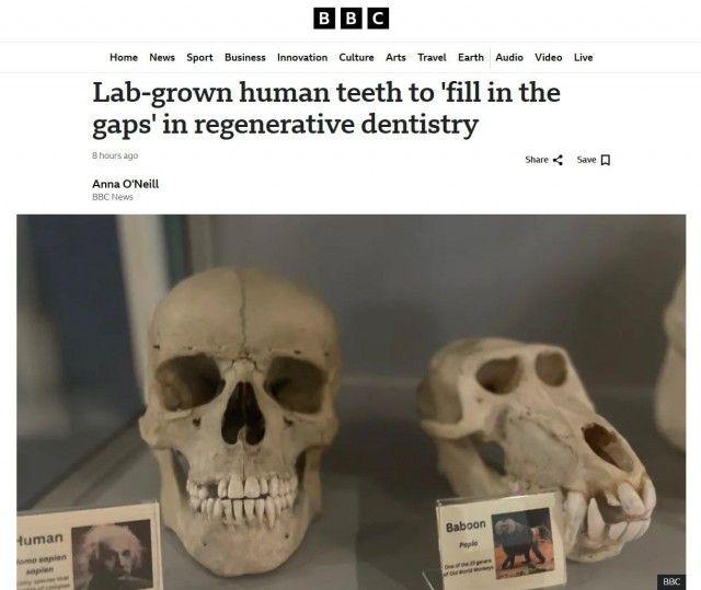 Ученые вырастили человеческий зуб в лабораторных условиях