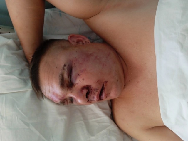 В Забайкалье избили участника СВО, потерявшего в бою ногу, пишут в местных соцсетях.