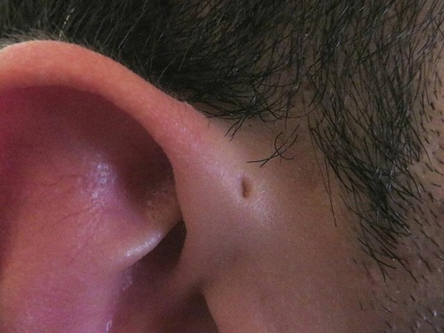 У некоторых людей есть крошечные отверстия на ушах, никто не знает зачем, но есть теория