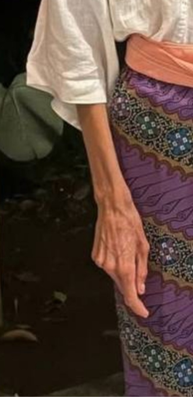 На Бали от истощения умерла женщина из Польши