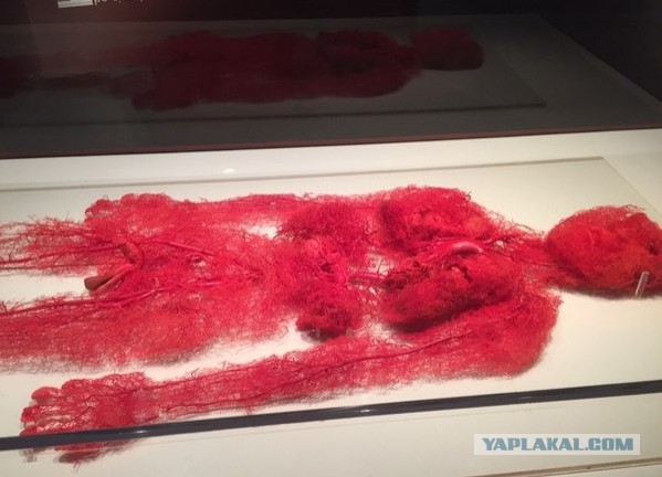 Кровеносные сосуды реального человека