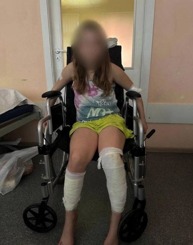 Питер: агрессивная собака покусала нескольких человек