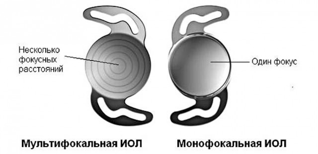 Стремительно старею или это норма?