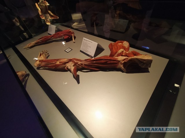 Посетил выставку Body Worlds на ВДНХ