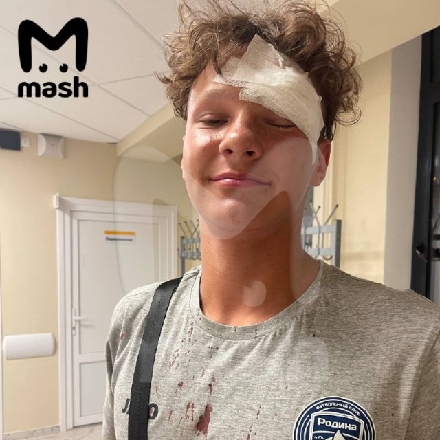 Мигранты избили 14-летнего перспективного вратаря ФК "Родина" в подмосковном Одинцове